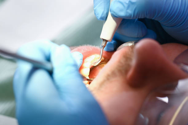 Best Dentist for Tooth Abscess  in Pardeeville, WI