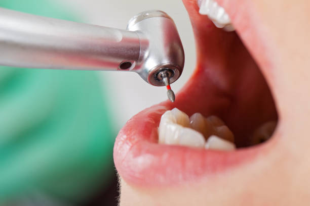 Best Tooth Infection Emergency Dentist  in Pardeeville, WI